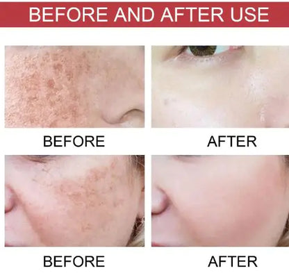 Niacinamide  Moisturizing Care Solution