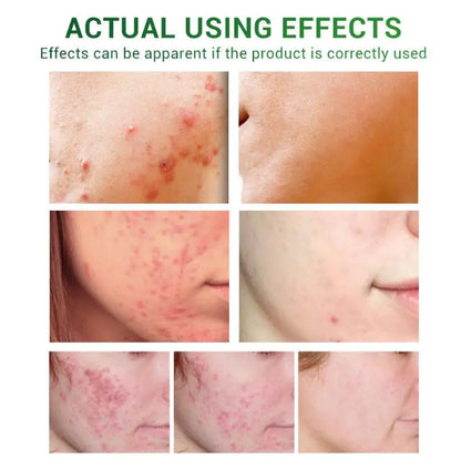 Essential Oils for Scar Repair and Skin Care