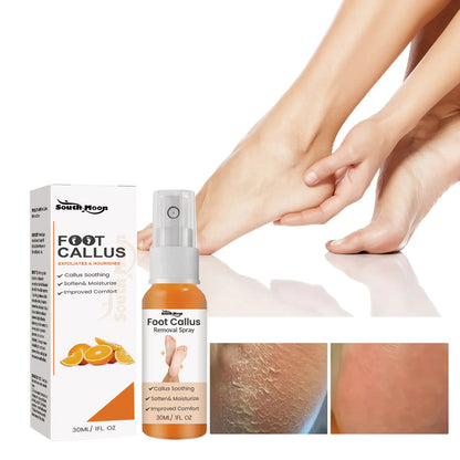 South Moon Foot Exfoliating Spray for Rough Skin Care