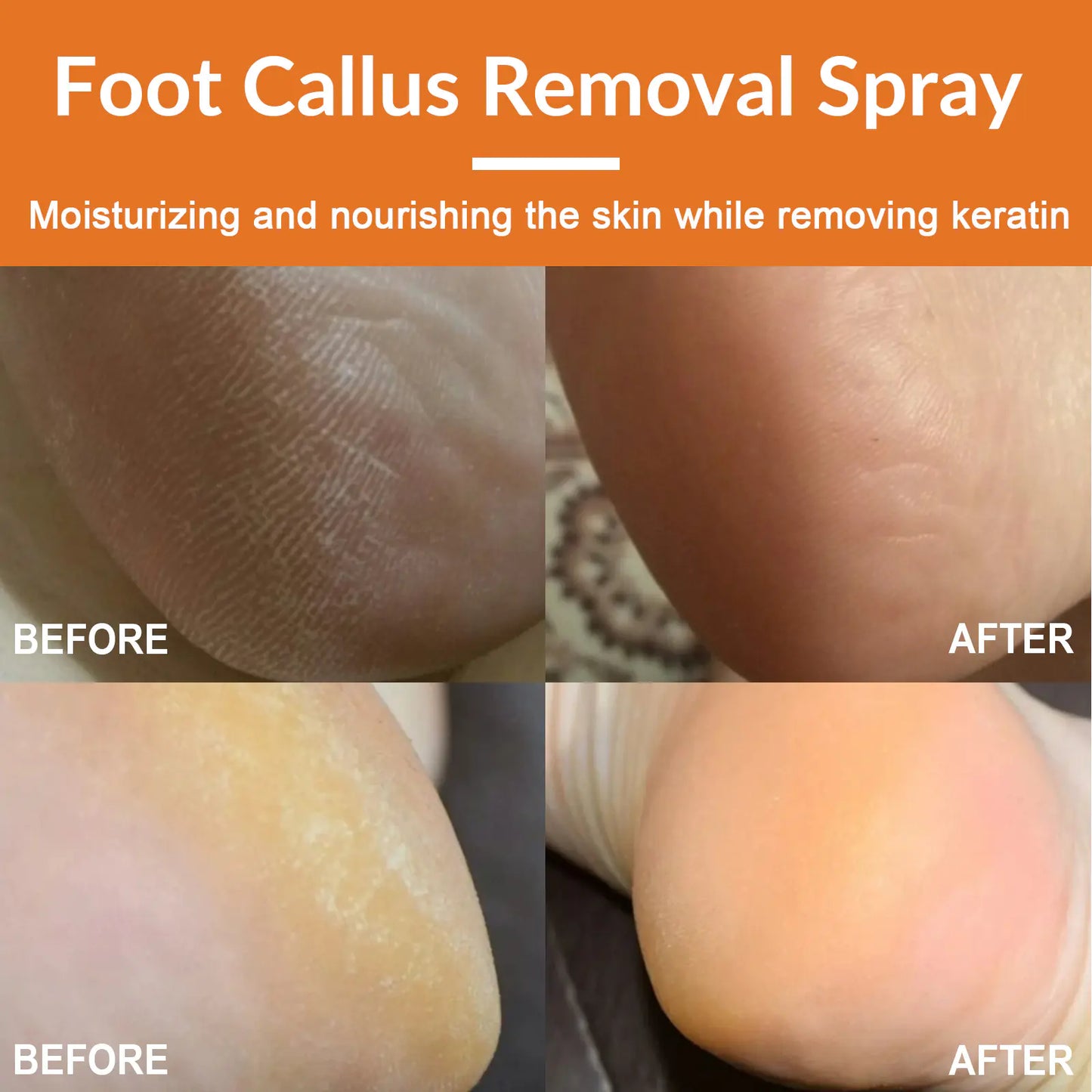 South Moon Foot Exfoliating Spray for Rough Skin Care